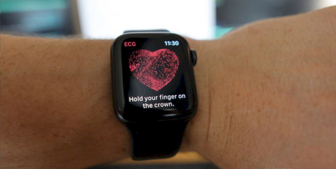 Cara Mudah Menggunakan Fitur ECG Pada Apple Watch